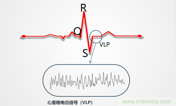 解決心電監(jiān)測行業(yè)難題，曼森伯格的濾波技術(shù)獲國家知識(shí)產(chǎn)權(quán)局發(fā)明授權(quán)